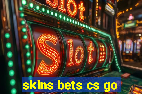 skins bets cs go