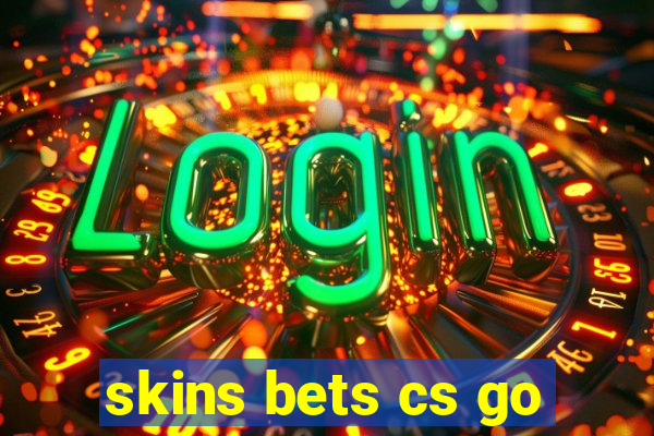 skins bets cs go