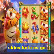 skins bets cs go