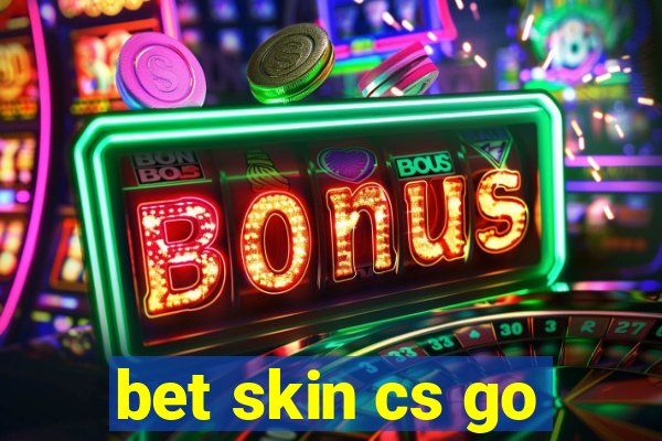 bet skin cs go