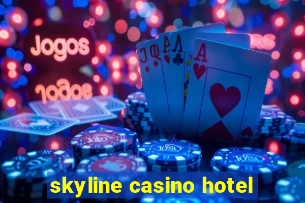 skyline casino hotel